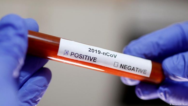 10 Saniyede Koronavirüsü tespit eden yerli test kullanımda